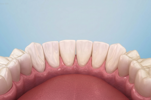 Limpieza Dental 4