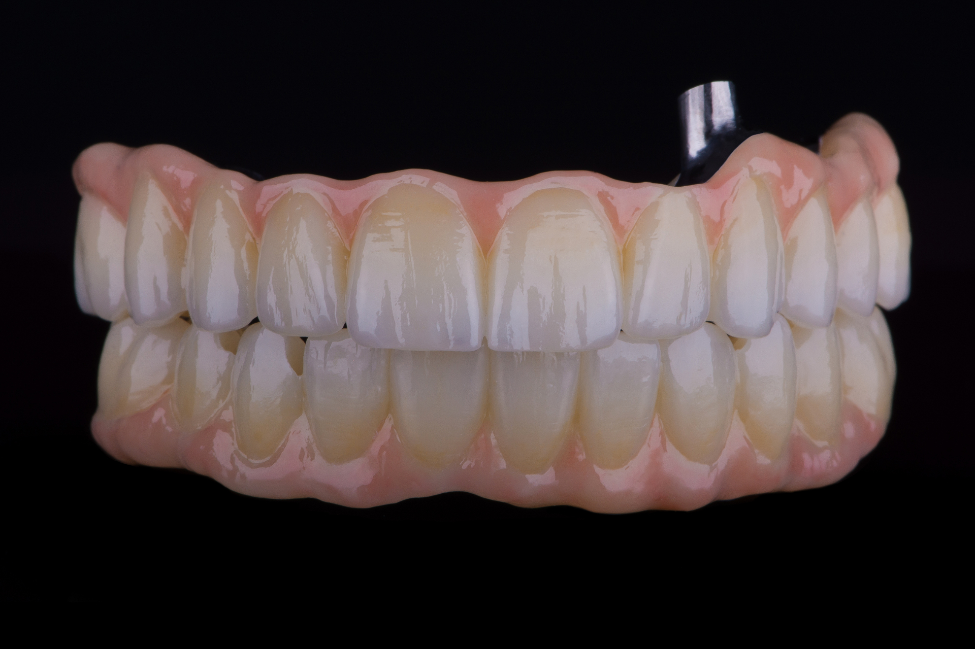 Prótesis e Implantes 3