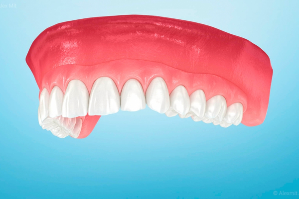 Prótesis e Implantes 1